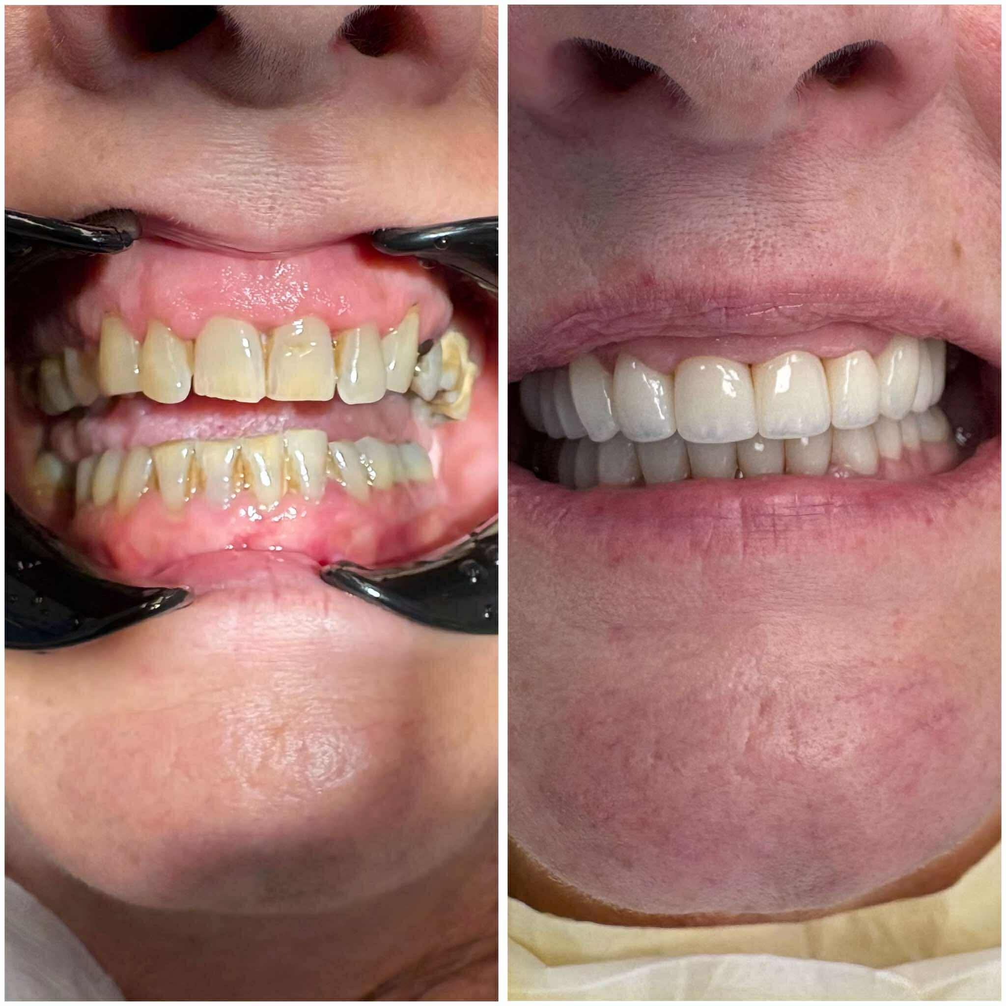 115aa07c9ae3de4cda4a3aa5b4182ca7