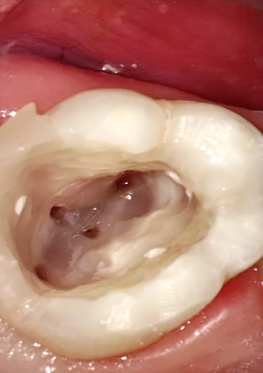 20260408_16_37_23_937