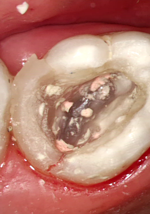 20260408_17_03_41_422