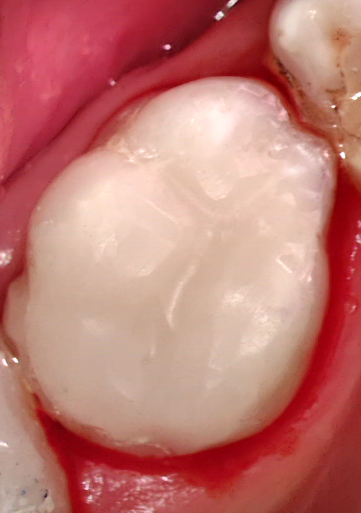 20260408_17_20_05_752