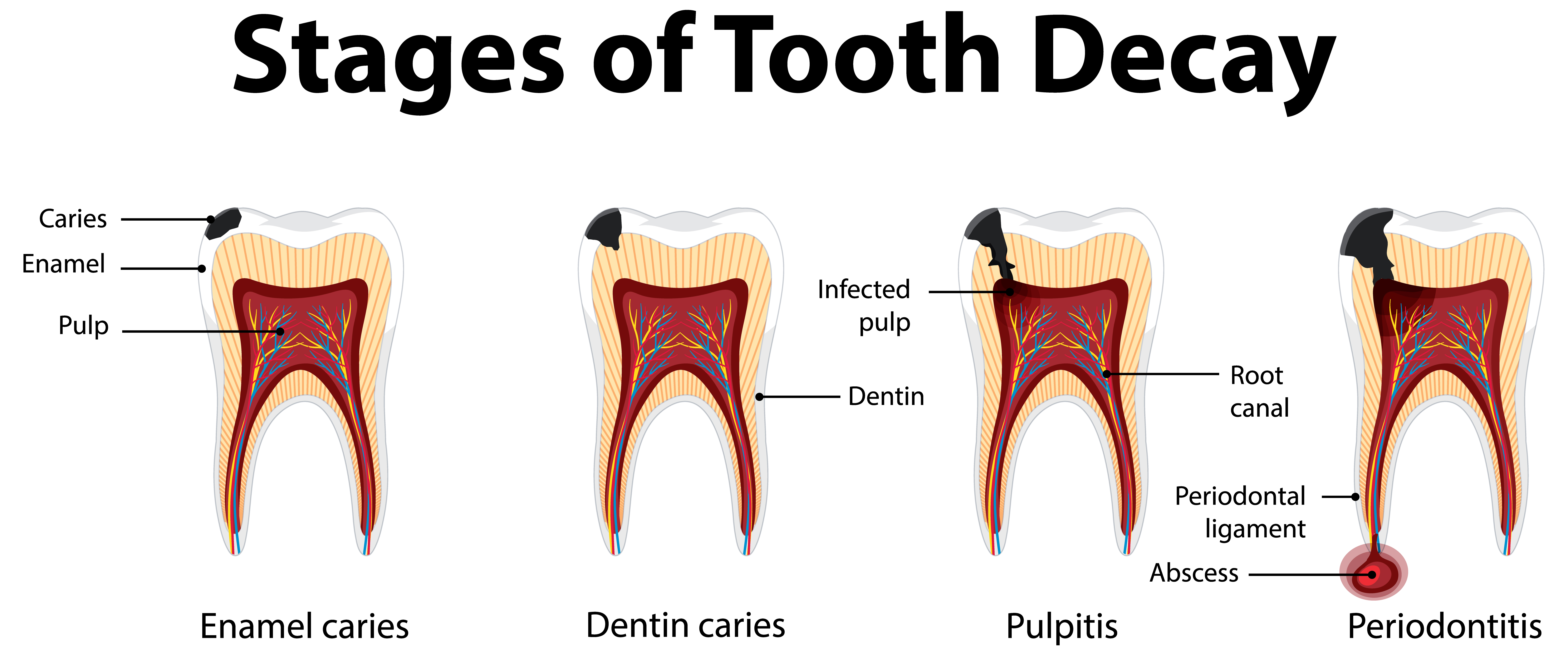 26213194_fm4k_flt3_220301