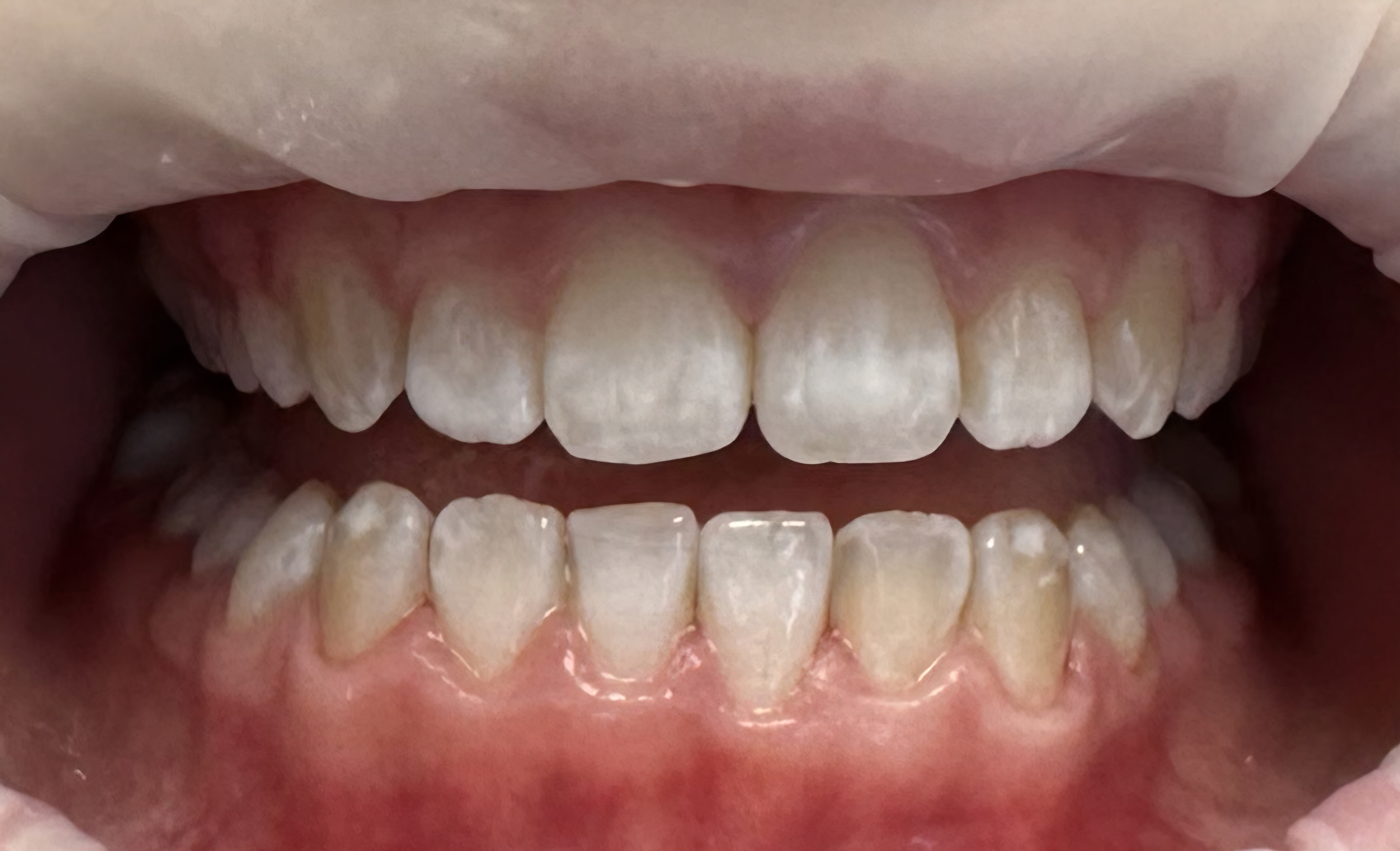 Hamperger Brigi utána