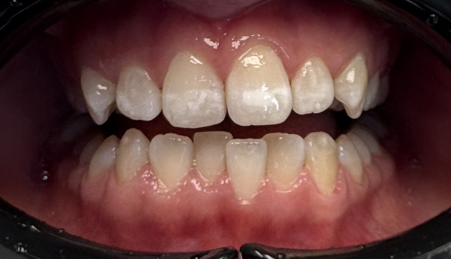 Hamperger Brigitta előtte