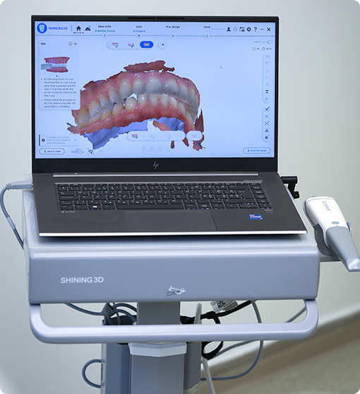 Digitális lenyomat alapján tervezett fogtechnikai termékek